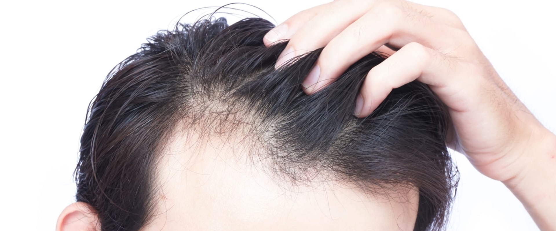What to Do When Experiencing Sudden or Unexpected Hair Loss