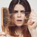 Everything You Need to Know About Hair Loss