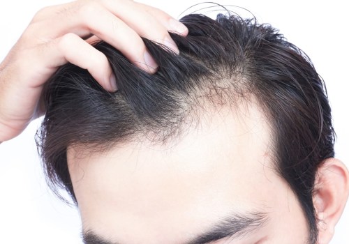 What to Do When Experiencing Sudden or Unexpected Hair Loss