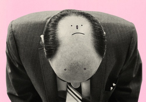 Preventing Hair Loss: Tips and Strategies to Stop Hair Loss
